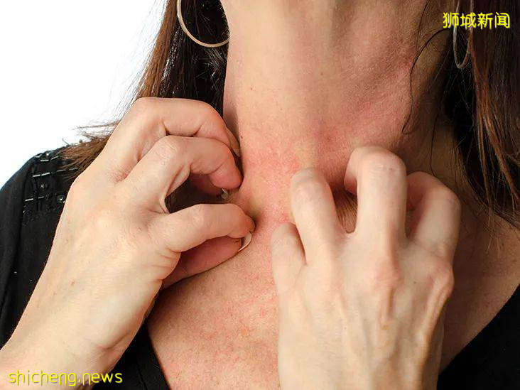 科興來了！新加坡網友：能優先入境中國，多少錢都打！女生混打科興和輝瑞，結果