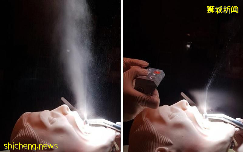 “无形口罩” 防牙科治疗时气溶胶飞散 降低冠病感染风险