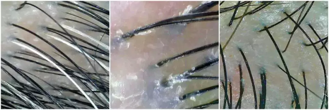 困扰七成新加坡人的烦恼 有对策了