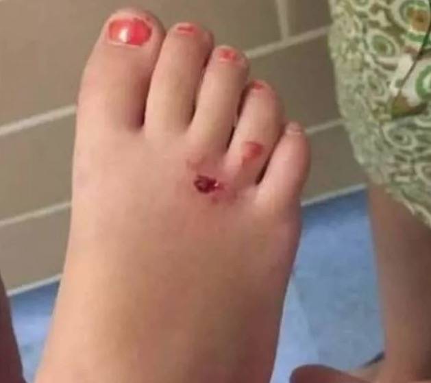 最近，兩人深夜在新加坡遭野豬襲擊，被咬著拖行一米，鮮血淋漓！這個地區要小心