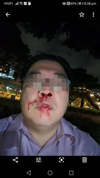 “这不是你爷爷的路！”  人行道路霸 打到人骨折 