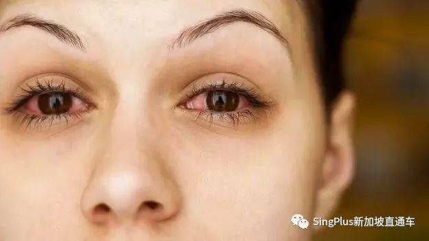 新冠還未過去，更可怕的“新冠後遺症”悄然降臨！新加坡已有客工出現症狀