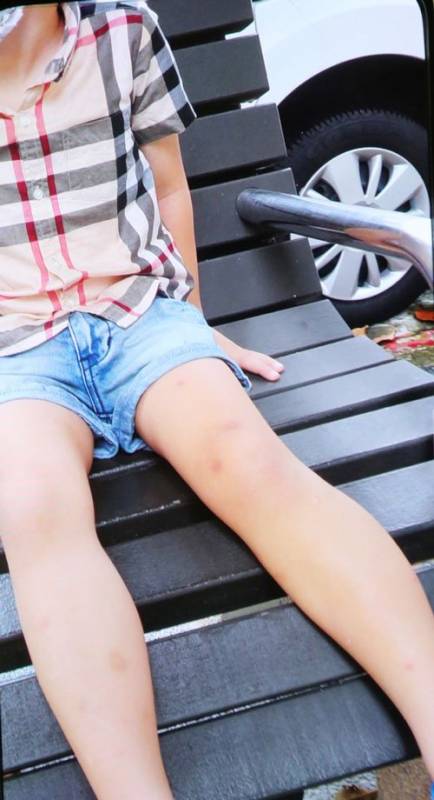 少妇轰老师虐待 像捉兔 伤我儿