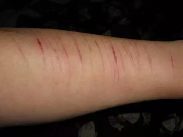 “我在大巴窑看到了有人闹跳楼,警察和民防部队出动,铺安全气囊!”