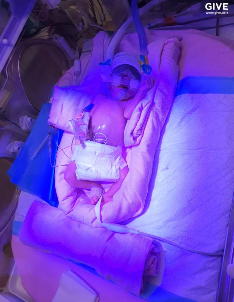 因誕下早産兒,這對馬來西亞夫婦在新加坡傾家蕩産