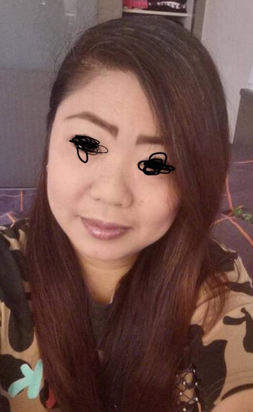 6年前,她在新加坡的中餐馆被毁容!最终获赔10万新币