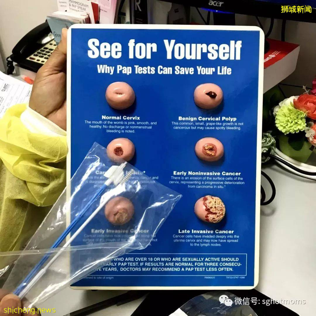 中國貴上天還約不到的HPV，新加坡竟然免費打，女性還能免費體檢