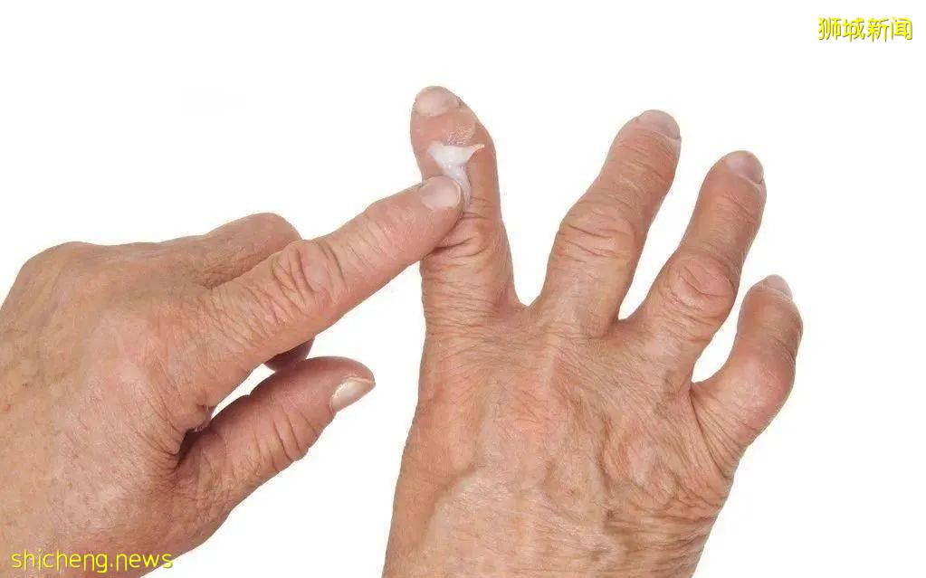 风湿病肆虐新加坡，我们该如何预防