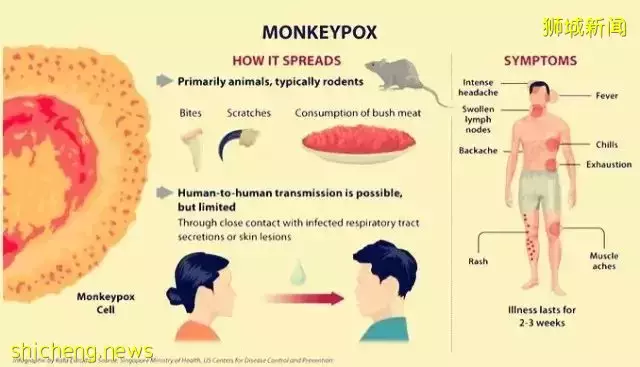 猴痘肆虐!无针对治疗方法!新加坡将保持高度警惕