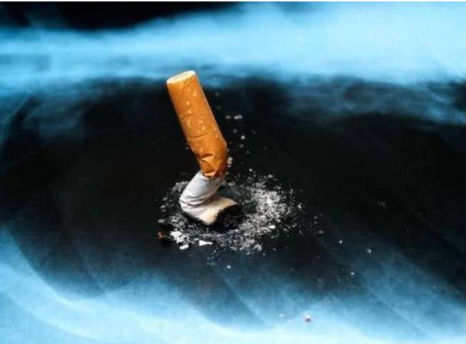 新加坡三个孩子的父亲因脚疼就医确诊癌症，他的陋习很多人都在犯