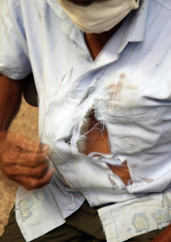 阿伯打喷嚏除口罩  遭人泼水攻击