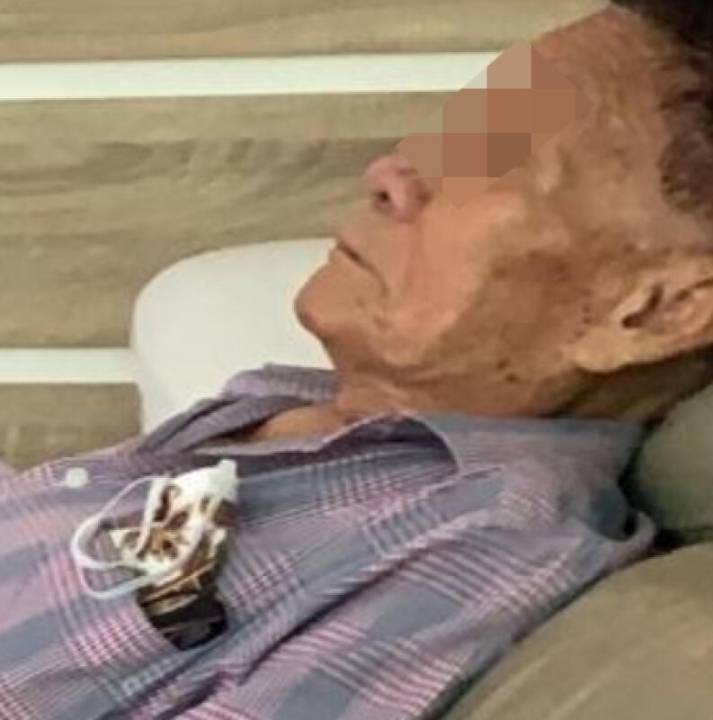 老翁洗臉被要價1.3萬‧美容院:去除220個油泡