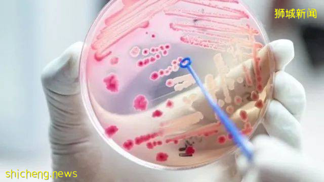 新加坡开发出一套测试模式,五分钟内计算出败血症死亡风险