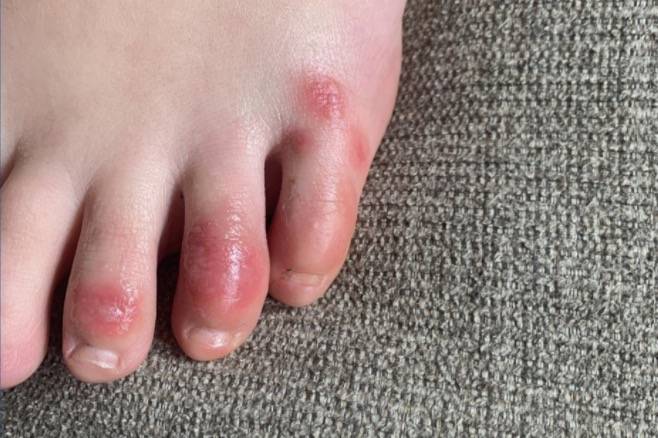 新加坡机场员工紧急检测!曝感染新冠后可能会出现这14种症状