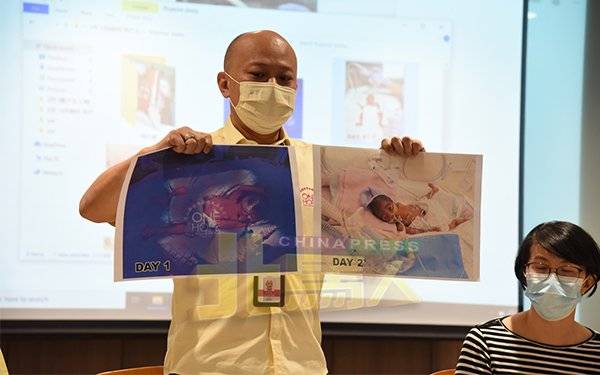 需待新国加护育婴箱 超早产儿要筹120万医费