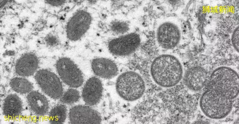 新加坡：本地尚未出现猴痘病例，但民众需加强防范