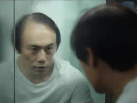 獅城這些“禿”如其來的煩惱,讓它幫你解決