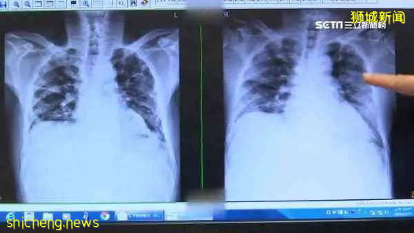 打完辉瑞疫苗5个月,防感染率骤降!新加坡已有人打完第三针科兴