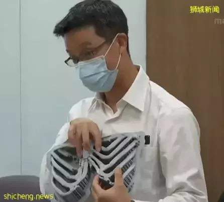 狮城医院3D打印胸腔　医治胸部畸形男子 